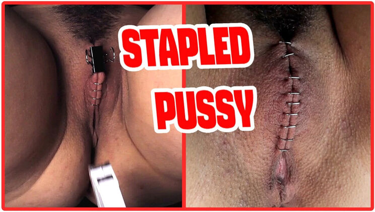 Sadistic Doctor Staples Teen Goth Girl's Hairy Pussy in Extreme BDSM Medical Punishment